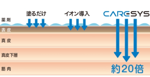 エレクトロポレーションとは