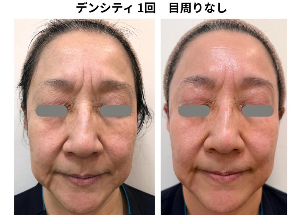症例写真